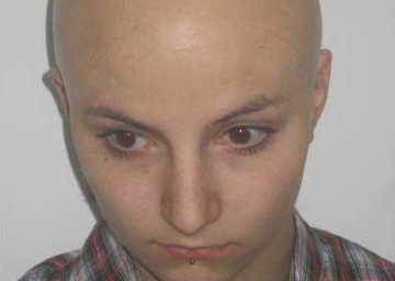 Bald Cap