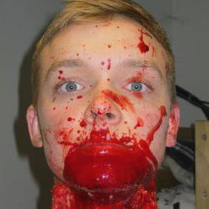 Slit Throat