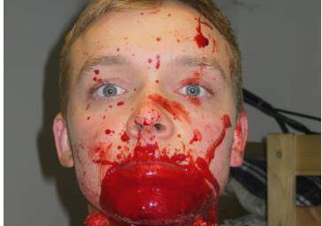 Slit Throat