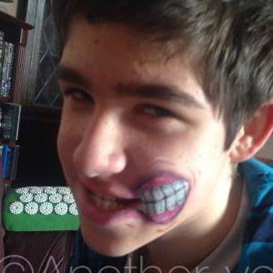 Stretched Mouth