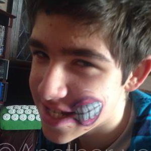 Stretched Mouth
